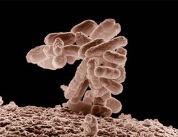 E. Coli bacteria